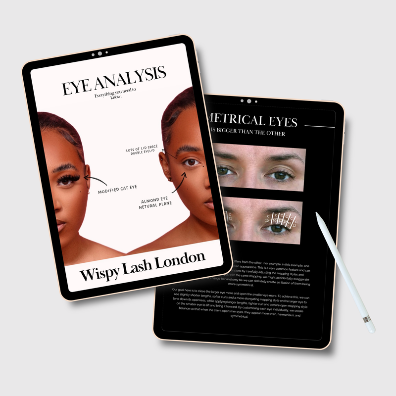EYE ANALYSIS E-BOOK